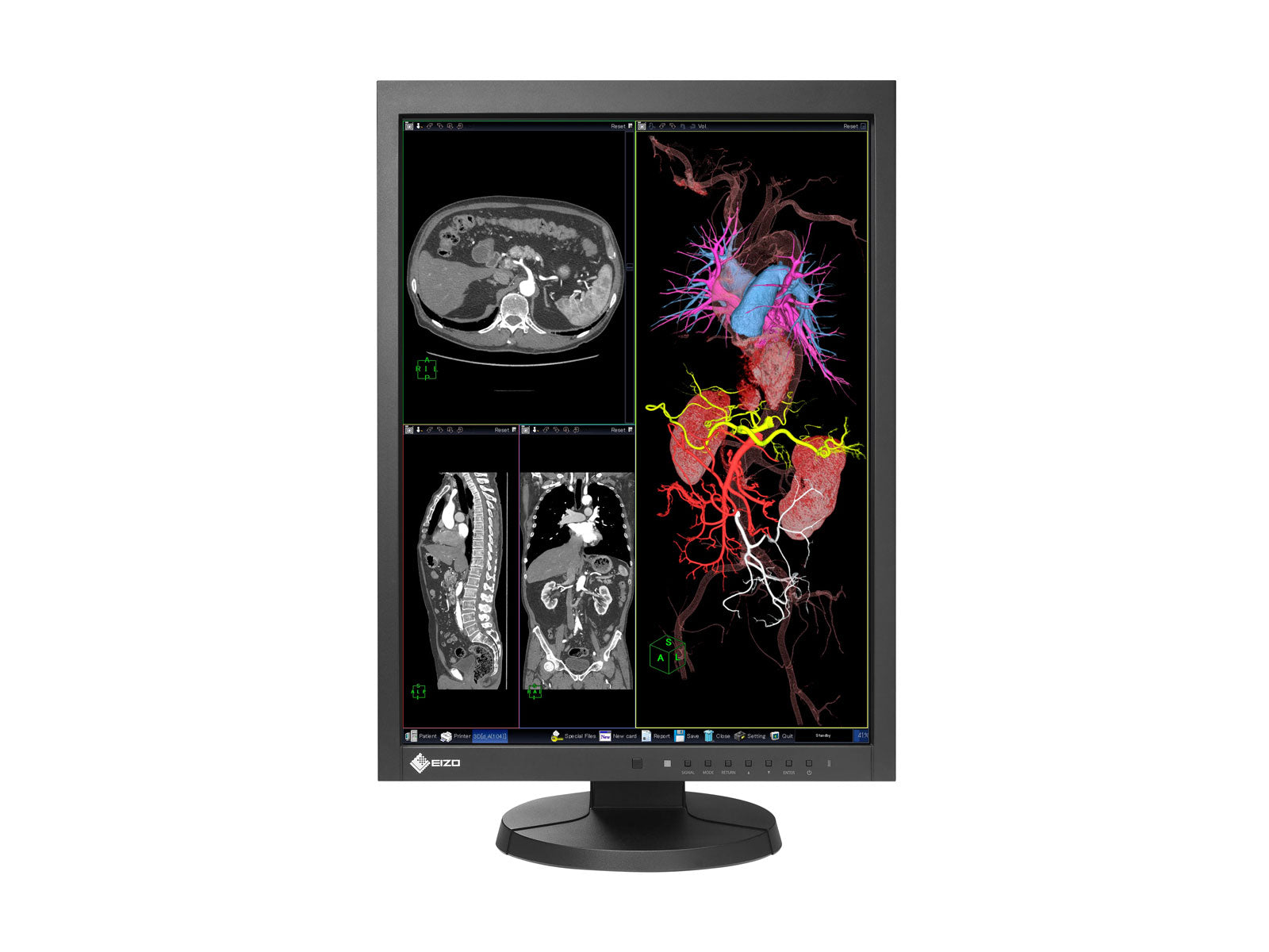 Eizo RadiForce MX215 2MP 21" Clinical Review Display (MX215-BK)