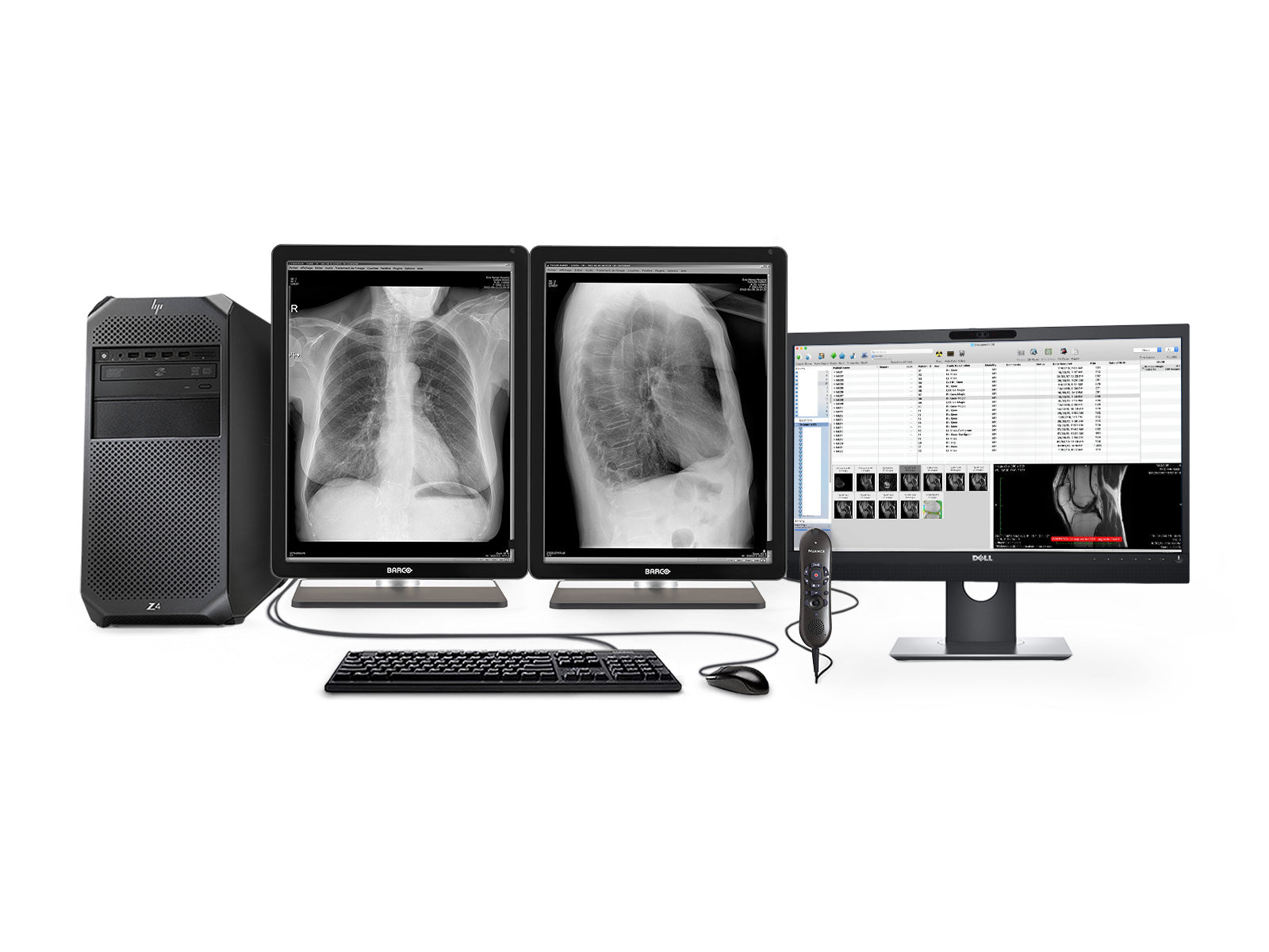 Complete PACS General Radiology Station | Barco 3MP Grayscale LED Displays | HP Workstation | Dictation Mic | Worklist Monitor (3221Z4R)