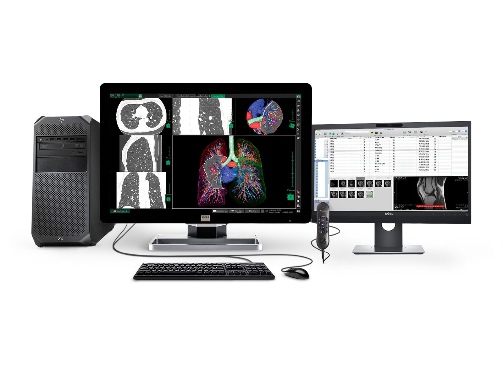 Complete PACS General Radiology Station | Barco 6MP Color LCD Display | HP Workstation | Dictation Mic | Worklist Monitor (6130Z4) (Copy) Monitors.com 