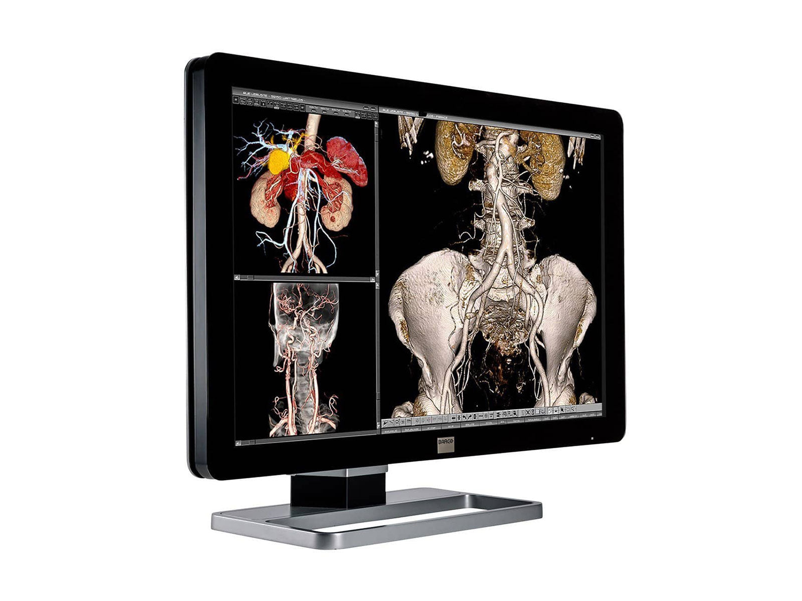 Barco Coronis Fusion MDCC-6230 6MP 30" Color LED General Radiology PACS Display Monitors.com 