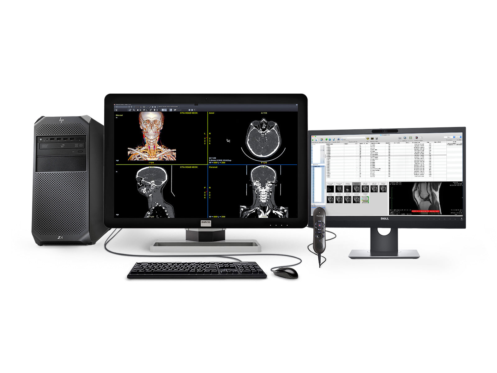 Barco General Radiology Reading Station | Coronis 6MP MDCC-6430 | HP Workstation | Nuance Mic | 24" Worklist Monitors (6430Z4R)