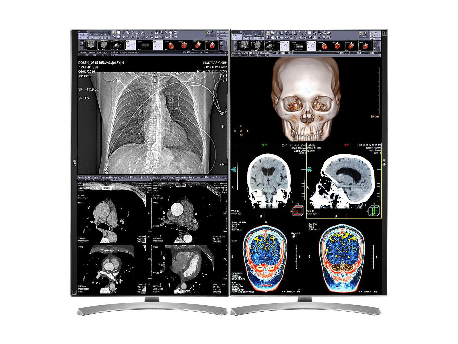 Tam Klinik İnceleme Okuma İstasyonu | 2 X LG 27 "8MP Renk Klinik İnceleme Ekranları | HP Zbook Studio 16 G9 | Dikte Mikrofonu | PerfectLum Kalibrasyon Paketi (LGHP16G9)