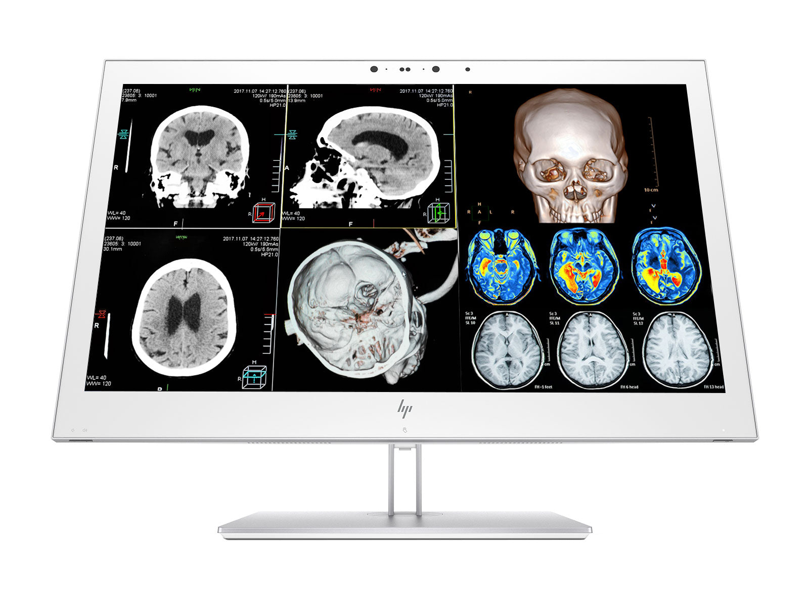 HP Healthcare Edition HC270cr 27" QHD Color Clinical Review Display Monitor (1QW03A8#ABA) Monitors.com 