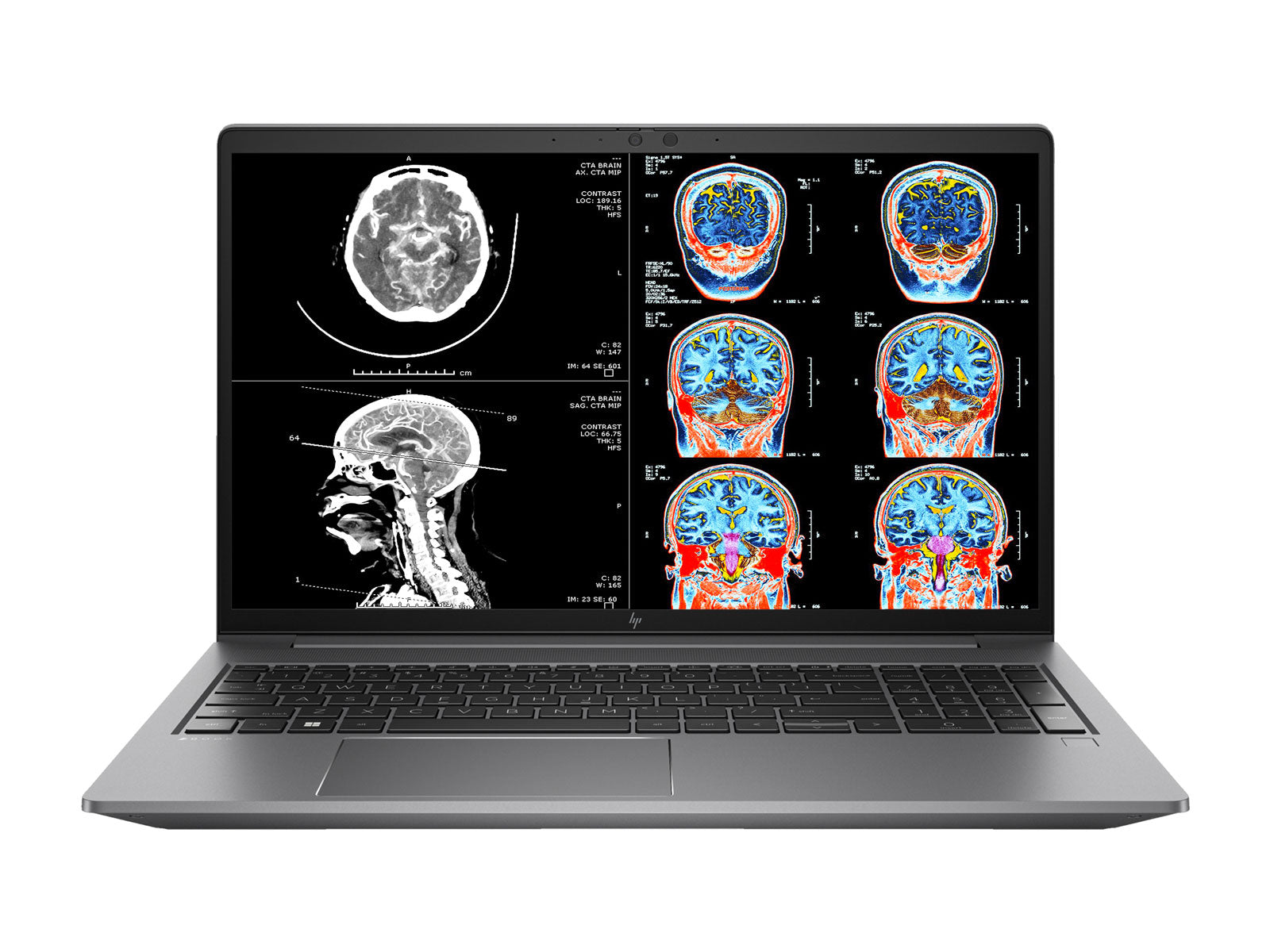 HP ZBook Power 15 G9 Mobile Radiology Workstation | 15.6" UHD 8MP+ DICOM Calibrated | Core i7-12700H @ 4.70GHz | 32GB DDR5 | 512GB NVMe SSD | NVIDIA RTX A2000 8GB | Win11 Pro Monitors.com 