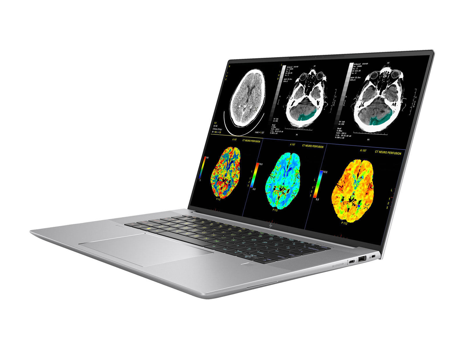 HP ZBook Studio 16 G10 Mobile Radiology WQUXGA DICOM Core i7-13800H 64GB DDR5 512GB NVMe Iris Xe 4GB