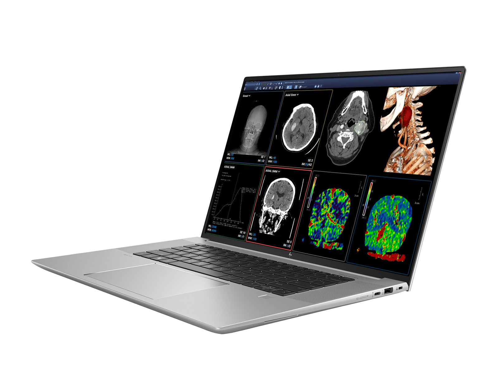 HP ZBook Studio 16 G9 Mobile Radiology Workstation | 16" WQUXGA OLED 8MP+ DICOM Calibrated | Core i7-12800H @ 4.80GHz | 64GB DDR5 | 1TB NVMe SSD | Nvidia RTX A4500 16GB | Win11 Pro Monitors.com 