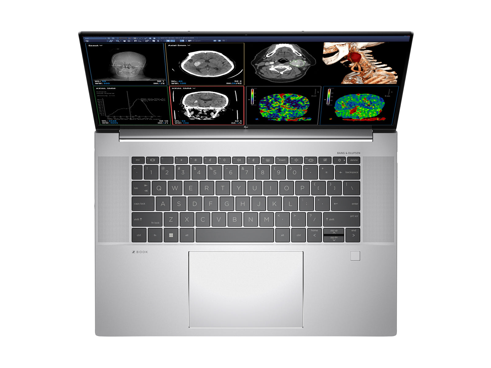 HP ZBook Studio 16 G9 Mobile Radiology Workstation | 16" WQUXGA 8MP+ DICOM Calibrated | Core i9-12900H @ 5.00GHz | 64GB DDR5 | 1TB NVMe SSD | Nvidia RTX A1000 4GB| Win11 Pro Monitors.com 