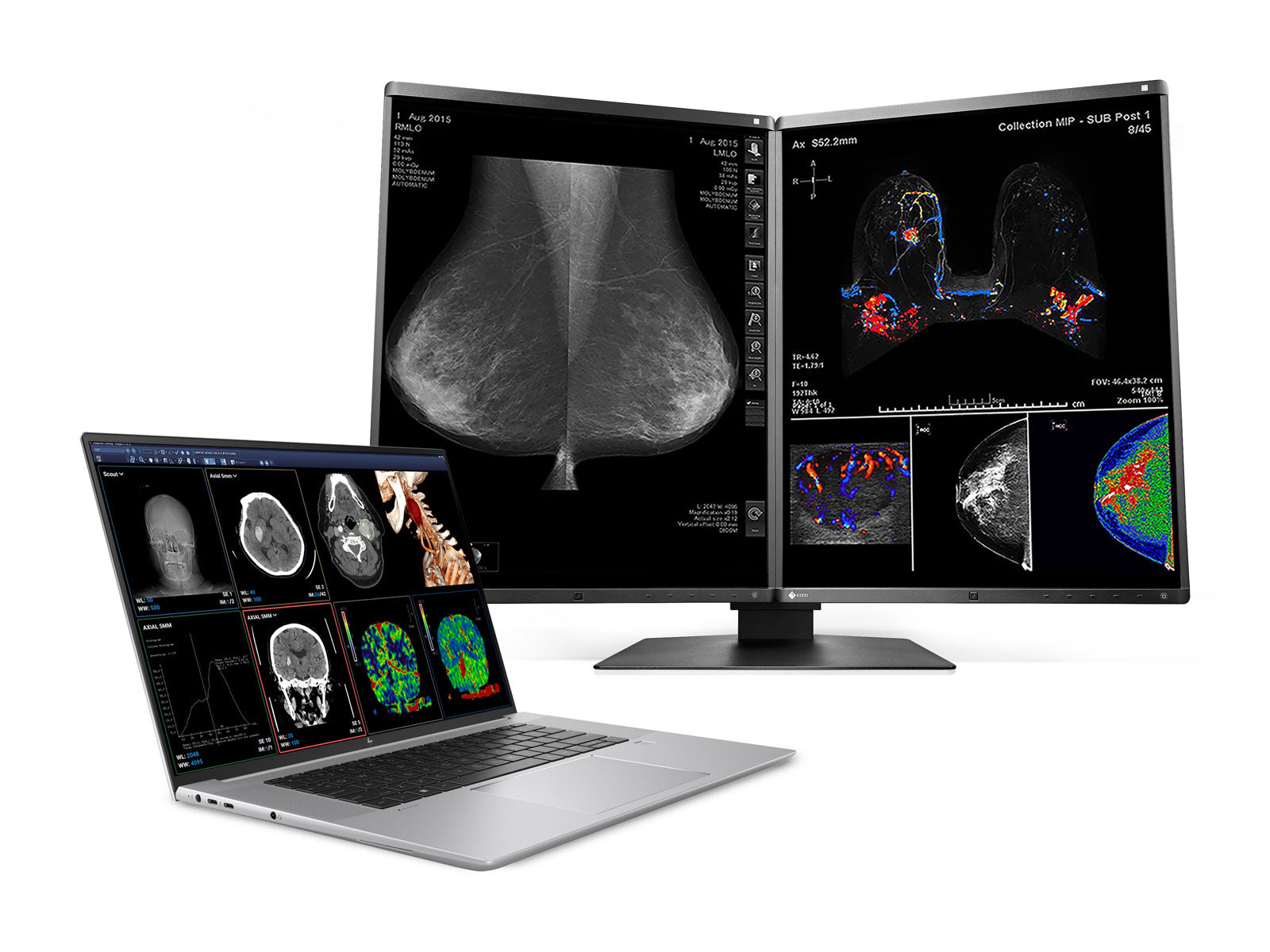 HP ZBook Studio 16 G9 Mobile Radiology Workstation | 16" WQUXGA OLED 8MP+ DICOM Calibrated | Core i7-12800H @ 4.80GHz | 64GB DDR5 | 1TB NVMe SSD | Nvidia RTX A4500 16GB | Win11 Pro Monitors.com 