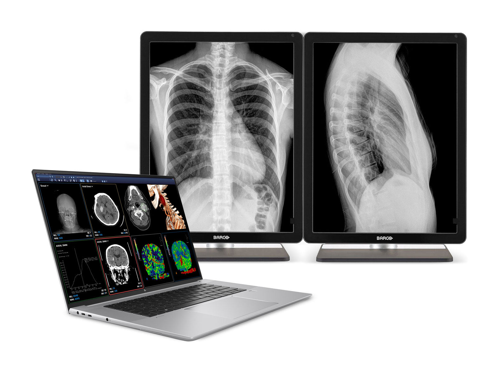 HP ZBook Studio 16 G9 Mobile Radiology Workstation | 16" WQUXGA 8MP+ DICOM Calibrated | Core i9-12900H @ 5.00GHz | 64GB DDR5 | 1TB NVMe SSD | Nvidia RTX A1000 4GB| Win11 Pro Monitors.com 