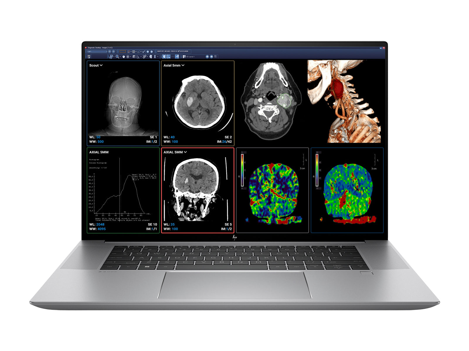 HP ZBook Studio 16 G9 Mobile Radiology Workstation | 16" WQUXGA 8MP+ DICOM Calibrated | Core i7-12700H @ 4.80GHz | 64GB DDR5 | 1TB NVMe SSD | Nvidia RTX A1000 4GB | Win11 Pro Monitors.com 