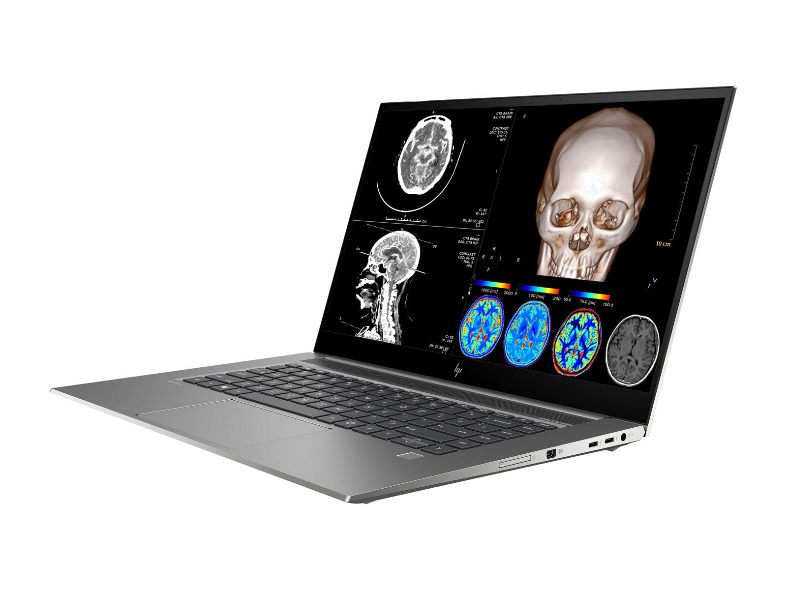 HP ZBook Studio 15 G8 Mobile Radiology Workstation | 15.6" OLED 8MP+DICOM Calibrated | Core i7-11800H @ 4.60GHz | 32GB DDR4 | 512GB NVMe SSD | Nvidia RTX 3060 6GB | Win11 Pro Monitors.com 