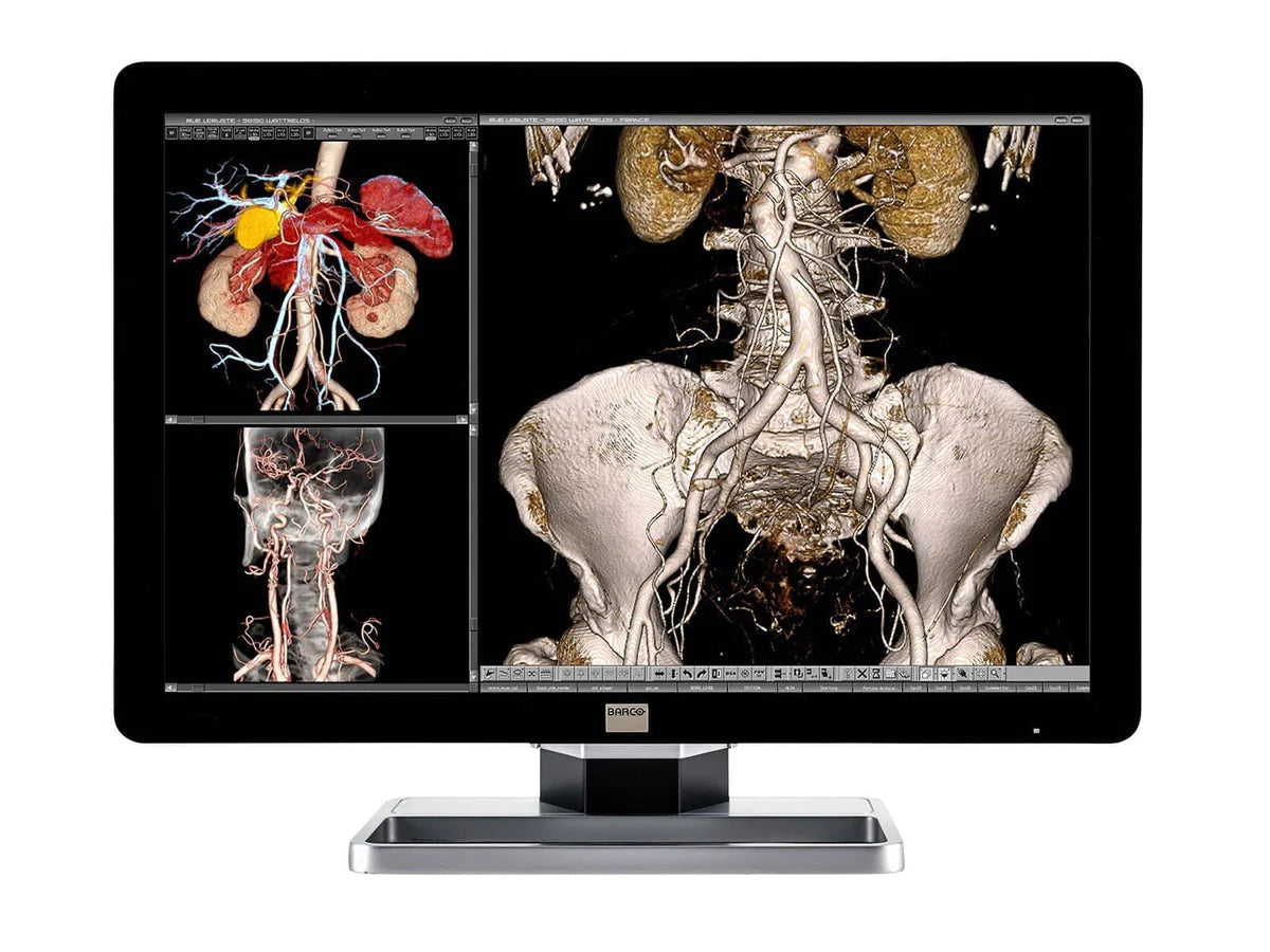 Barco Complete PACS General Radiology Station | HP Workstation