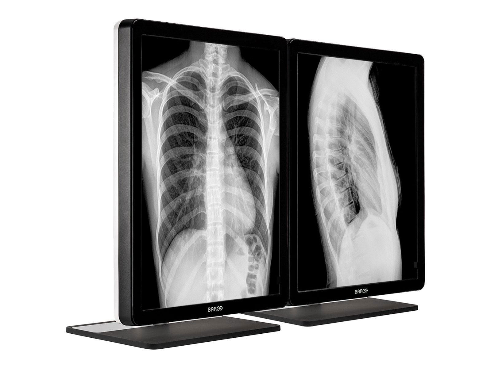 Barco Coronis MDCG-3221 3MP 21" Grayscale LED General Radiology Diagnostic Display Monitors.com 