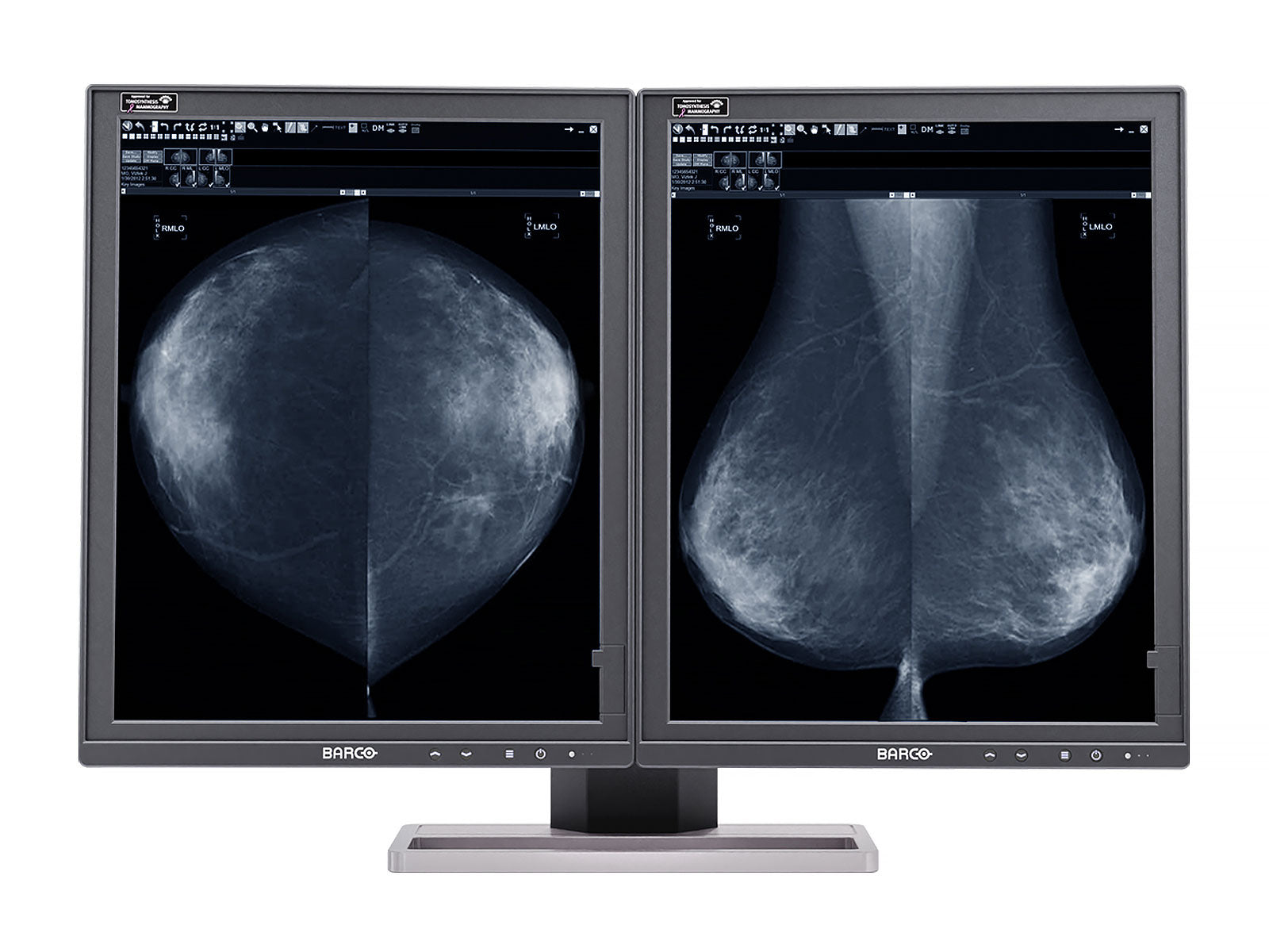 Barco Coronis MDMG-5221 5MP 21" Grayscale Tomosynthesis LED 3D-DBT Mammography Display Monitors.com 