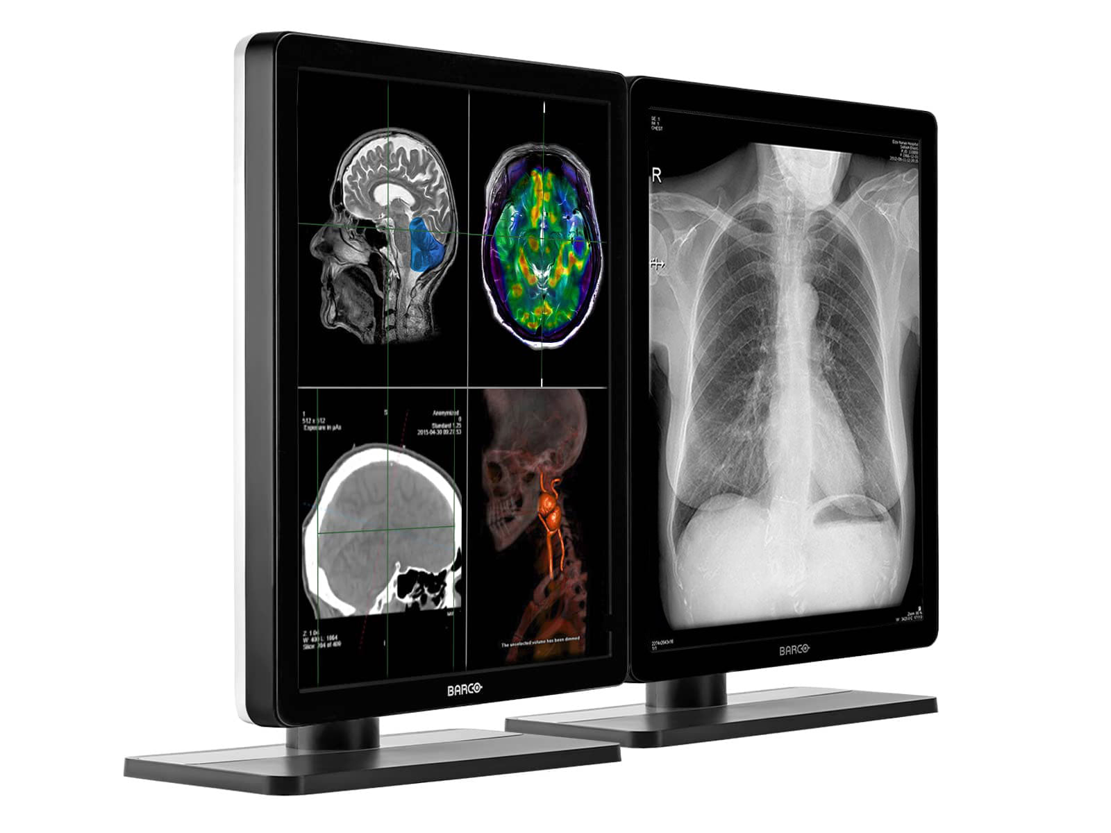 Barco Nio MDNC-3321 3MP 21" Color LED General Radiology Diagnostic PACS Display (Copy) Monitors.com 