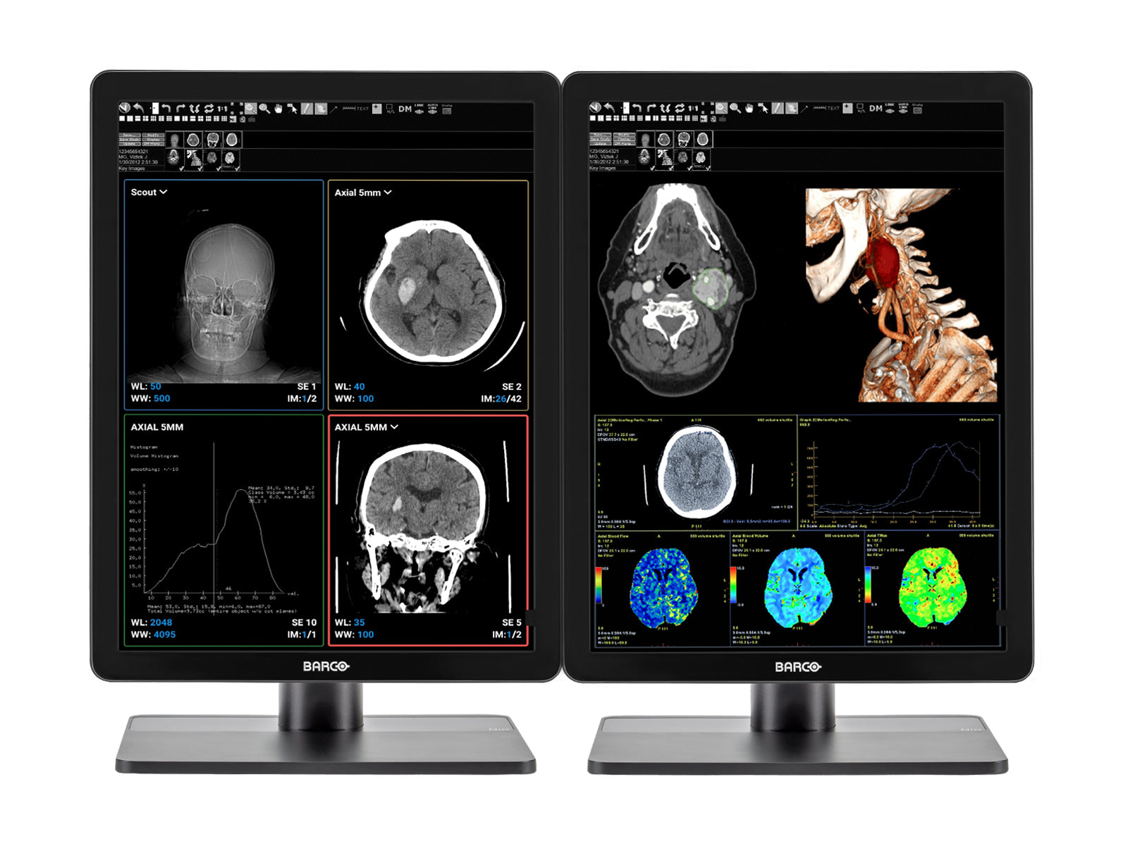 Barco Nio MDNC-3421 3MP 21" Color LED General Radiology PACS Display Monitors.com 