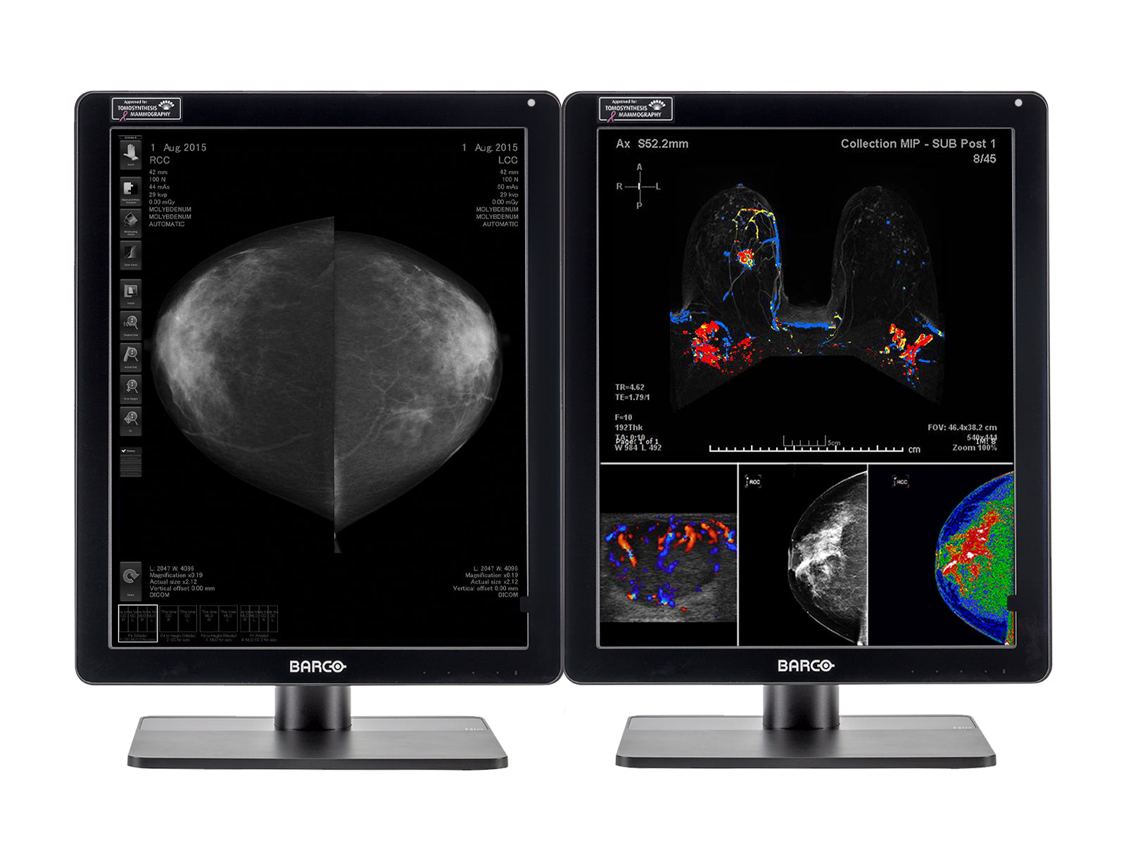 Complete Mammography Reading Station | Barco 5MP Color LED Monitor | Lenovo Workstation | Dictation Mic | Worklist Monitors (61212321N) Monitors.com 