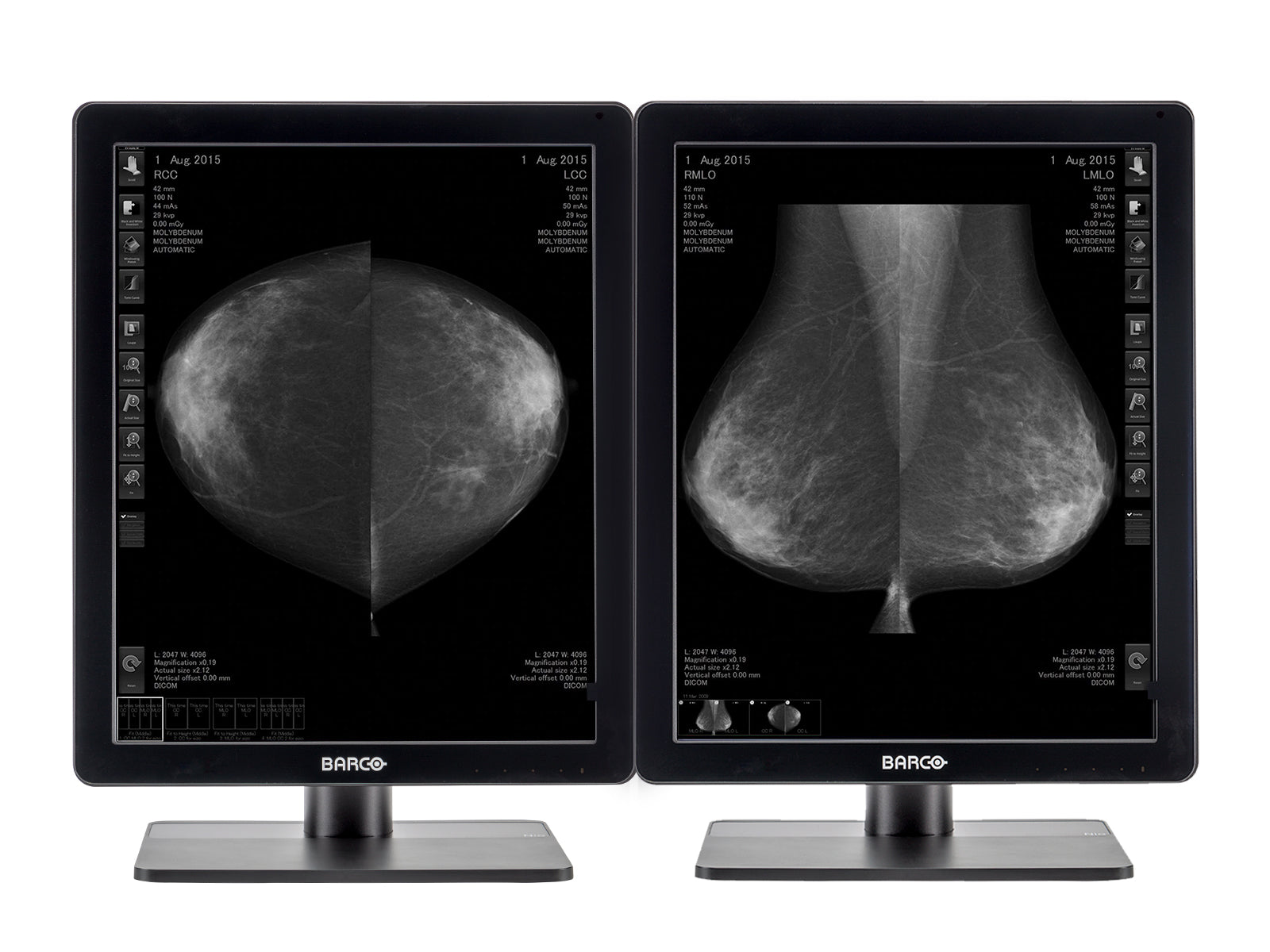 Complete Mammography Reading Station | Barco 5MP Grayscale LED Monitor | HP Workstation | Dictation Mic | Worklist Monitors (5221Z8N) Monitors.com 