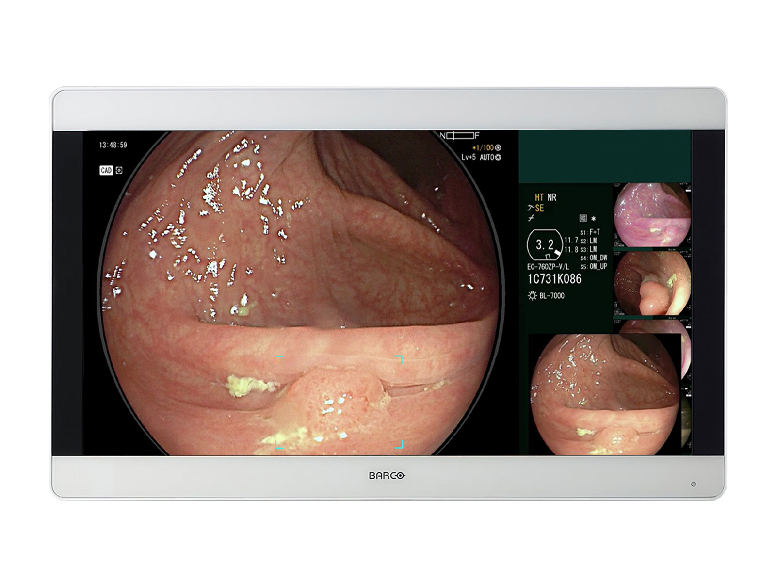 Barco MDSC-8331 31” 8MP 4K UHD Color Surgical Medical Display Monitor (991932399111) Monitors.com 