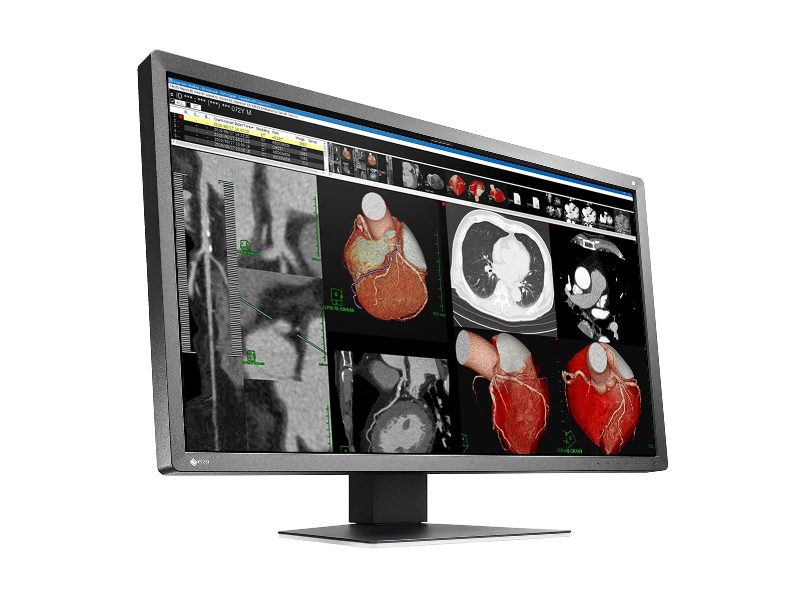 Eizo RadiForce MX317W 8MP 30" Color Clinical Review Display Monitor (MX317W-BK) Monitors.com 