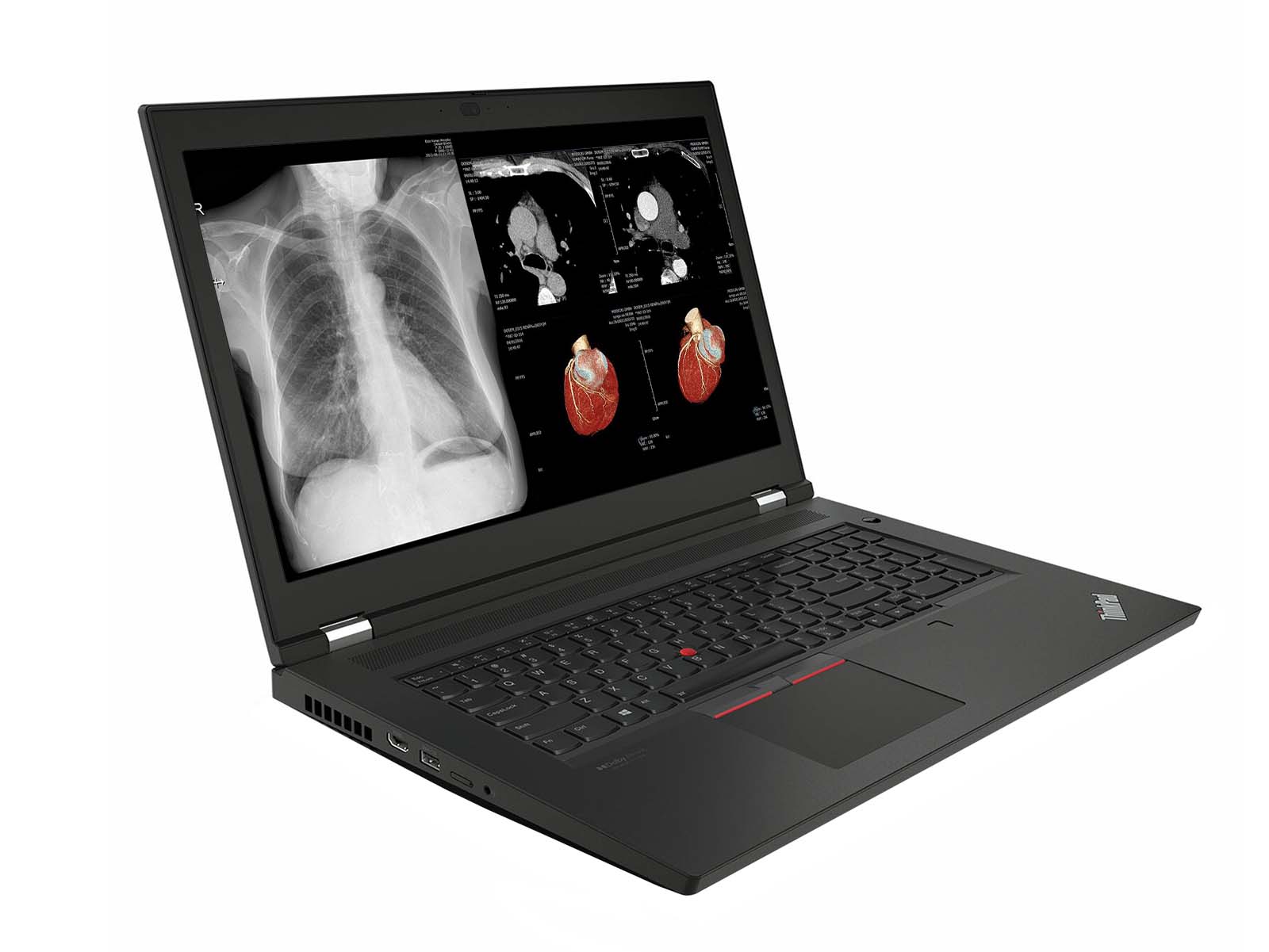 Lenovo ThinkPad P17 G2 Mobile Radiology Workstation | 17.3" 8MP DICOM Calibrated | Intel Core -i7-11850H @ 4.80GHz | 128GB DDR4 | 1TB NVMe SSD | NVIDIA RTX A5000 16GB | Win10 Pro Monitors.com 