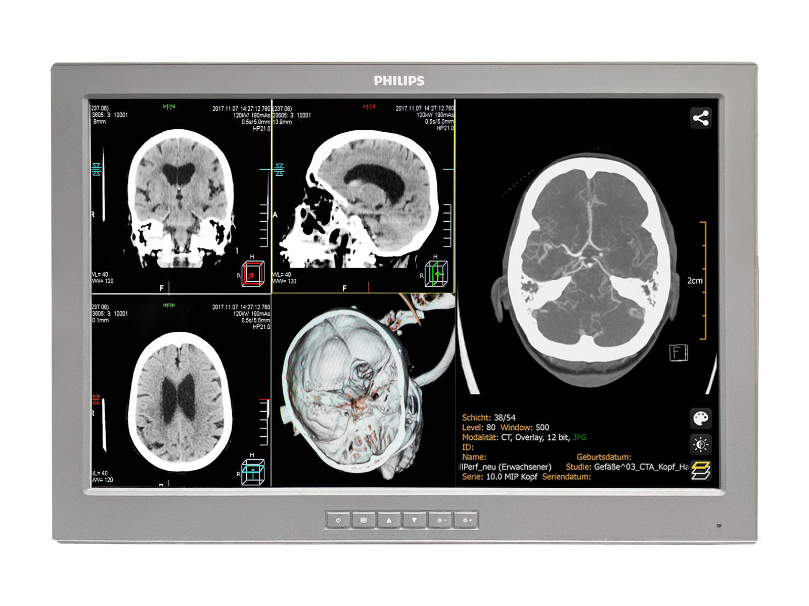 Barco P240-LTv Touchscreen MED24ESB 24" 2MP Philips DICOM (P240-LTv)