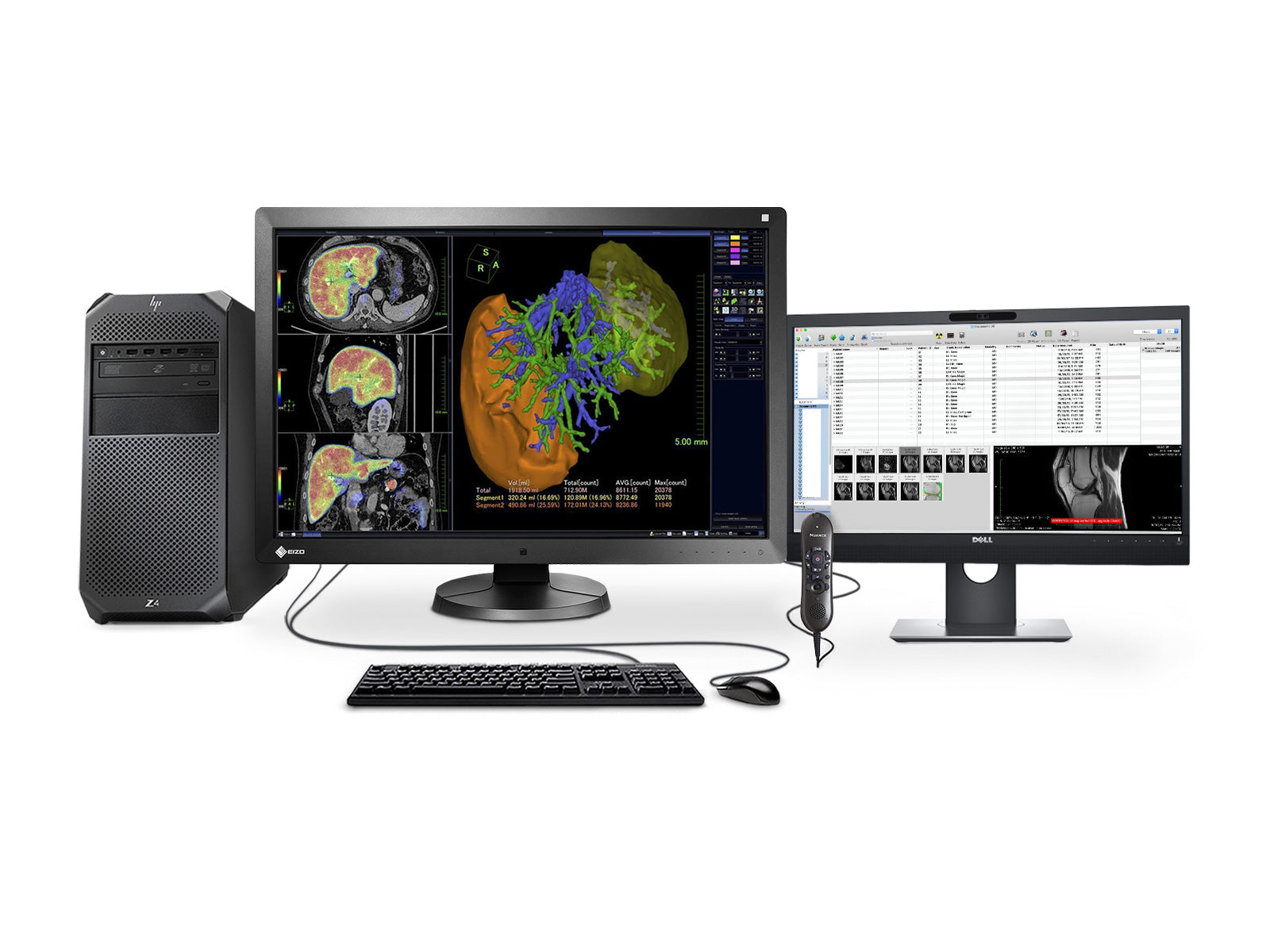 Complete PACS General Radiology Station | Eizo 6MP | HP Workstation