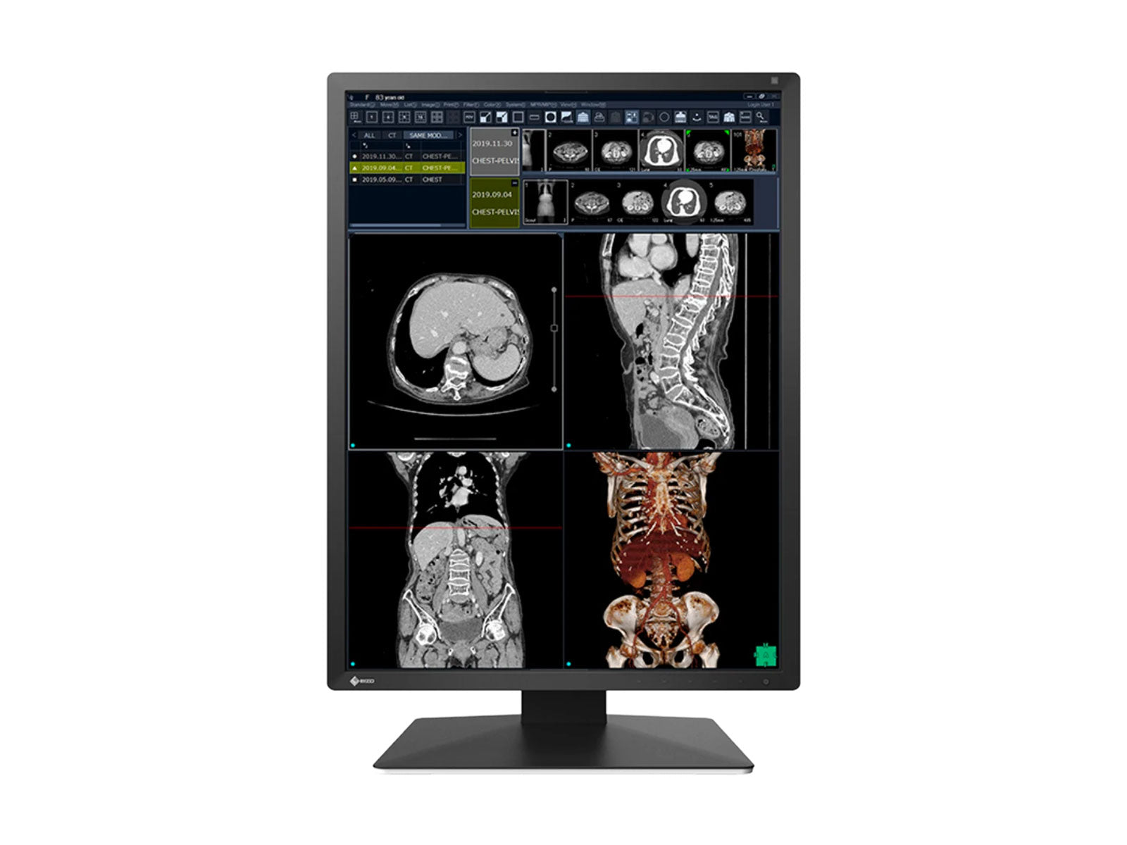 Eizo RadiForce RX270 2MP 21" Color LED Medical Diagnostic Radiology Display Monitor (RX270-BK) Monitors.com 