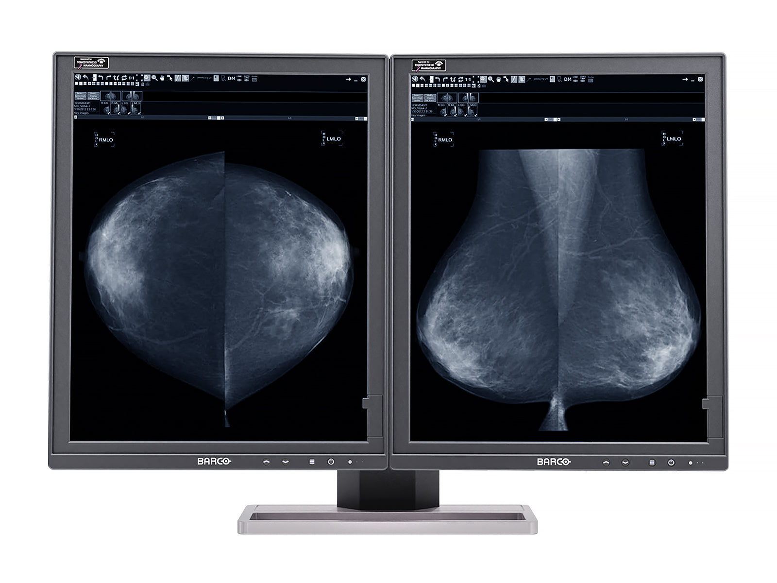 Complete Mammography Reading Station | HP Workstation