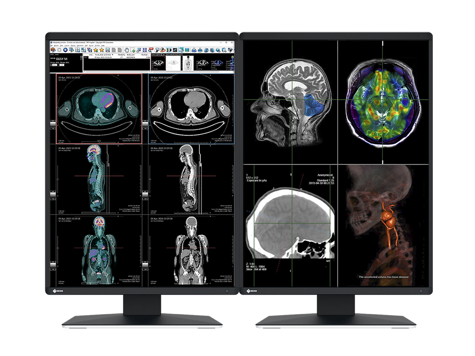 Eizo RadiForce RX370 3MP 21" Color LED General Radiology Diagnostic PACS Display (RX370) Monitors.com 