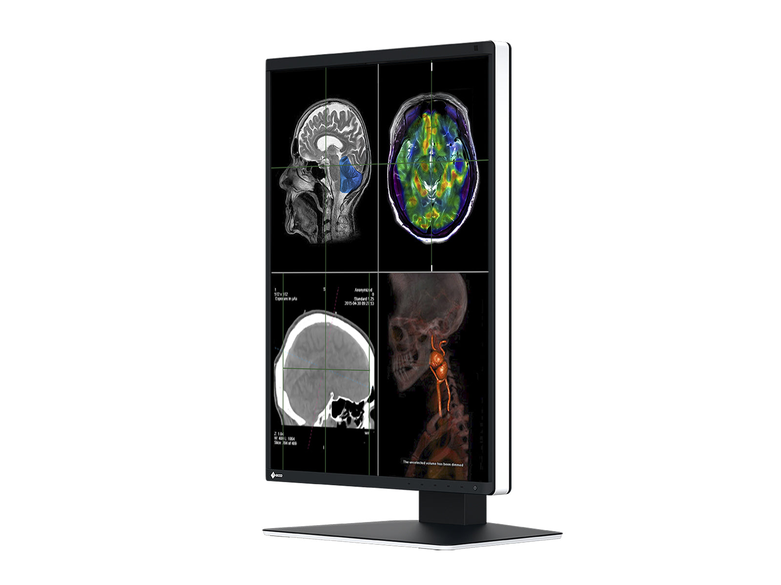 Eizo RadiForce RX370 3MP 21" Color LED General Radiology Diagnostic PACS Display (RX370) Monitors.com 