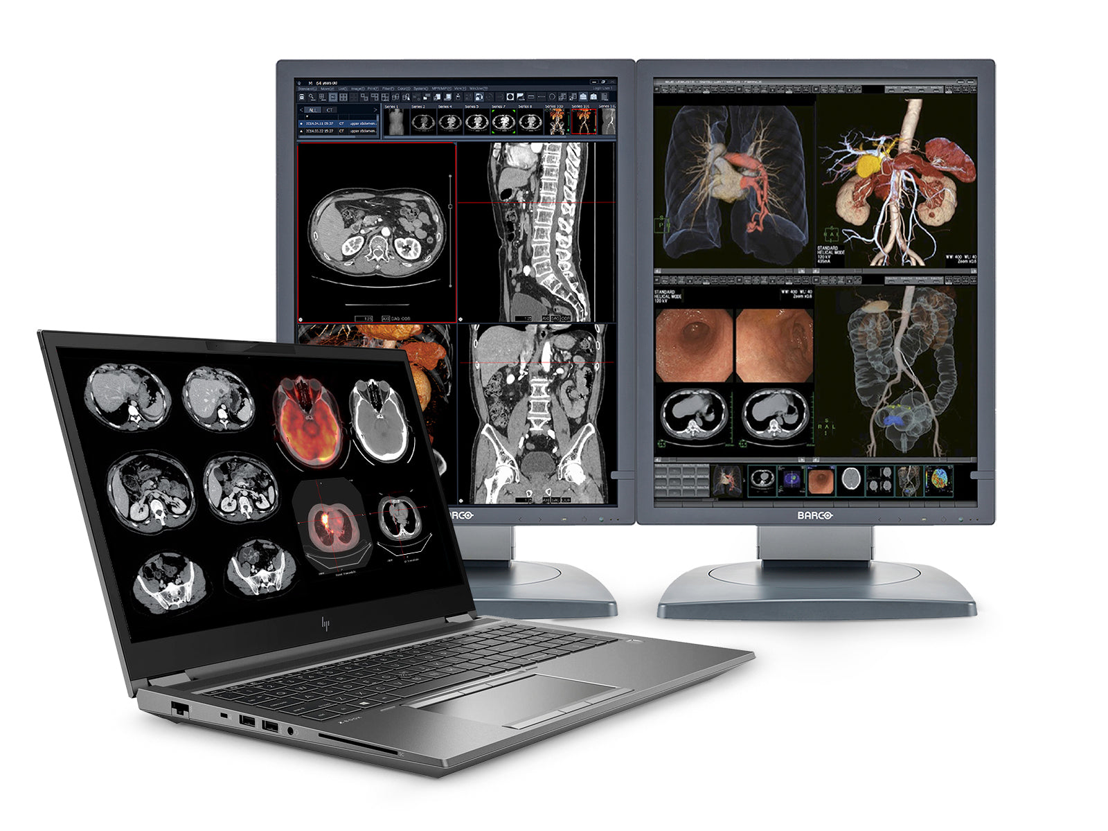 HP ZBook 15 G7 Mobile Radiology Workstation | 15.6" Full HD LED | Core i9-10885H @ 5.30GHz | 8-Core | 64GB DDR4 | 512GB NVMe SSD | Quadro RTX 3000 6GB | Win10 Pro Monitors.com 