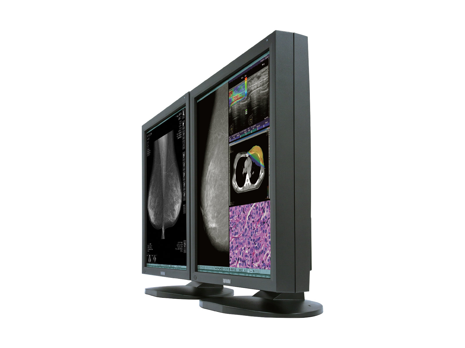 JVC Totoku CCL550i2 5MP 21" Color LED Mammo 3D-DBT Breast Imaging Display (CCL550i2) Monitors.com 