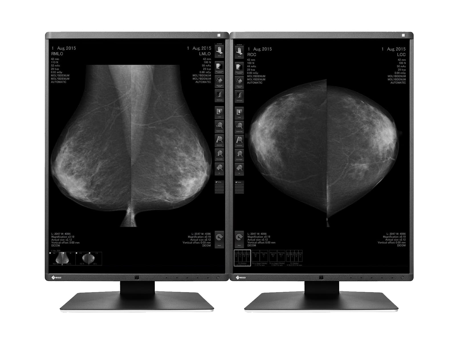 Eizo RadiForce GX560 5MP 21" LED Grayscale Mammo 3D-DBT Breast Imaging Display Monitor (GX560-MD) Monitors.com 