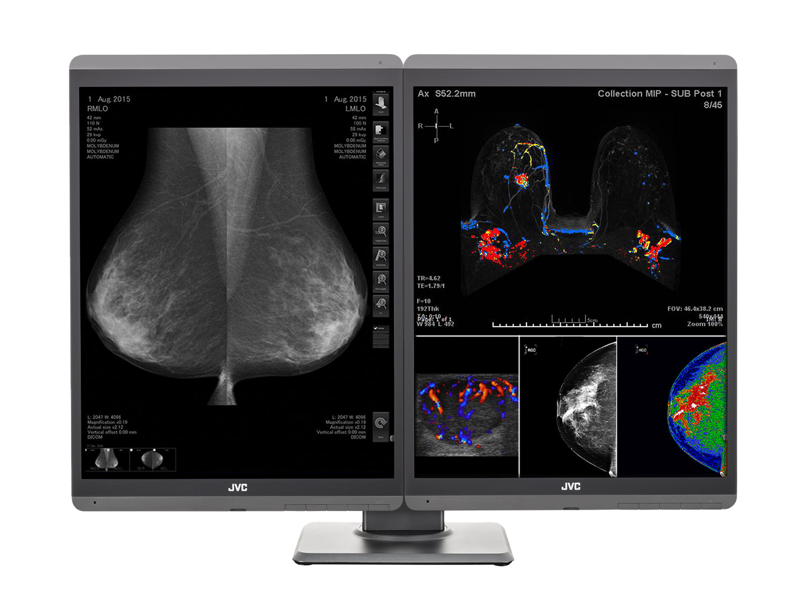 JVC Totoku CL-S500 5MP 21" Color LED Mammo 3D-DBT Breast Imaging Display (CL-S500) Monitors.com 