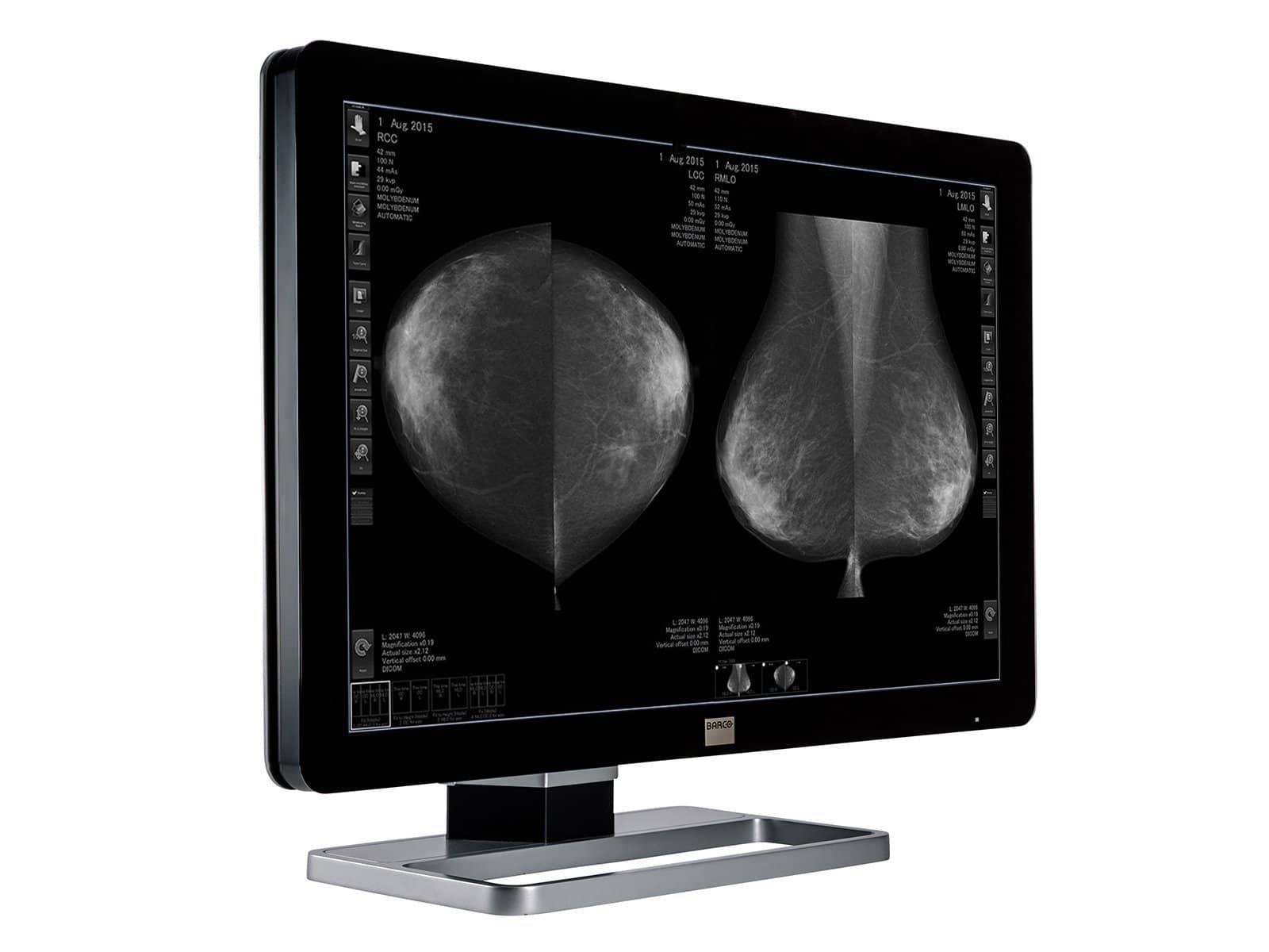 Barco Coronis Fusion MDCG-10130 10MP 30" Grayscale Mammo 3D-DBT Breast Imaging Display Monitors.com 