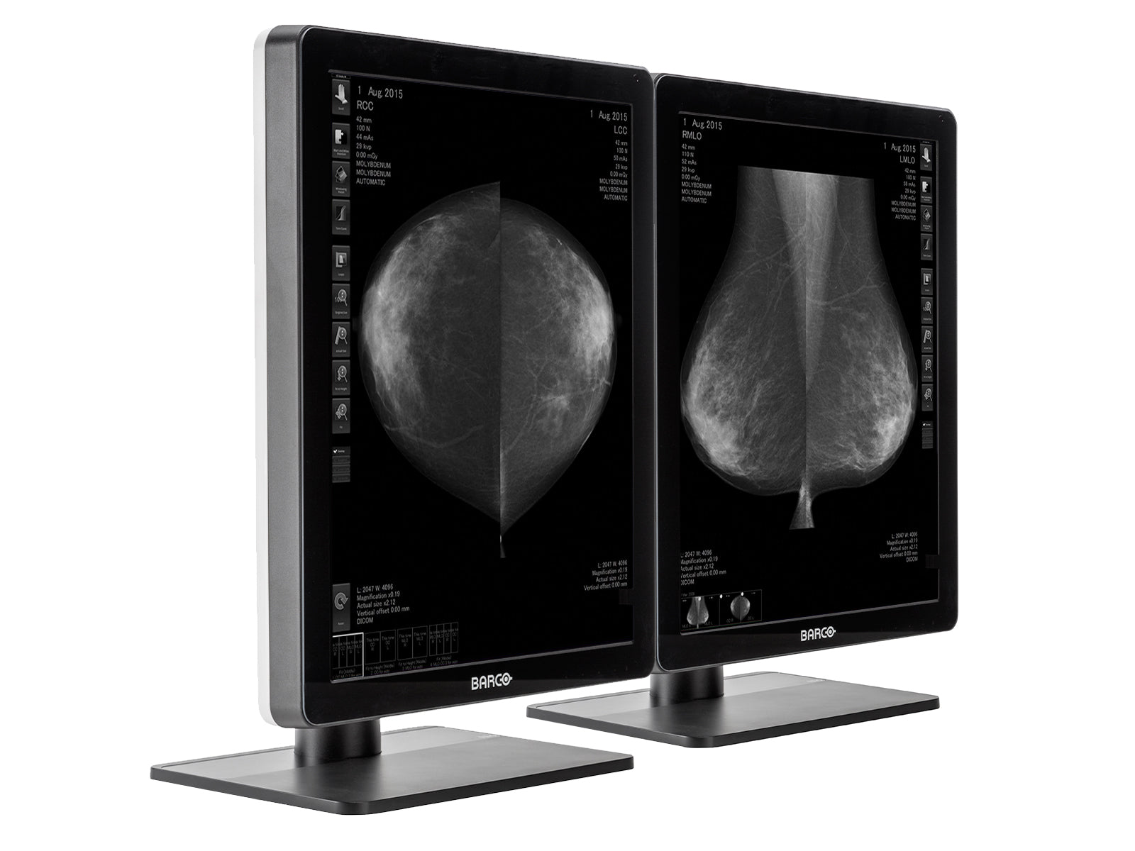 Complete Mammography Reading Station | HP Workstation