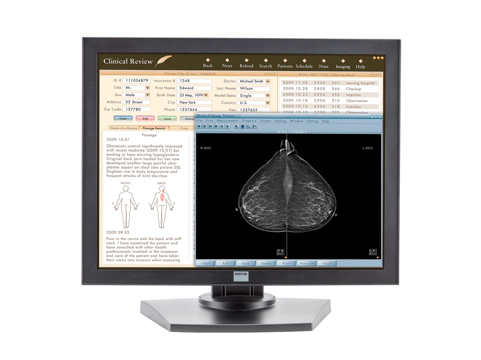 Complete Mammography Reading Station | HP Workstation