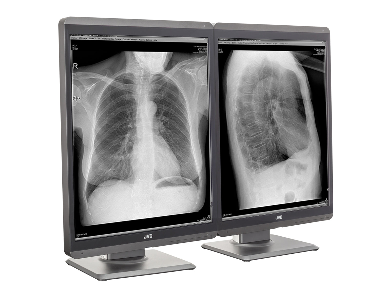 JVC Totoku MS-S200 2MP 21" Grayscale Diagnostic Radiology Display Monitor (MS-S200) Monitors.com 