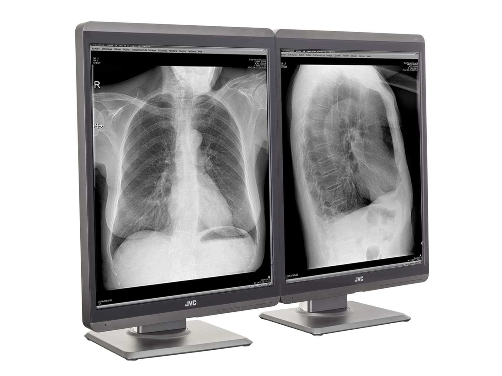 JVC Totoku MS-S300 3MP 21" LED Grayscale General Radiology Diagnostic Display Monitor (MS-S300) Monitors.com 