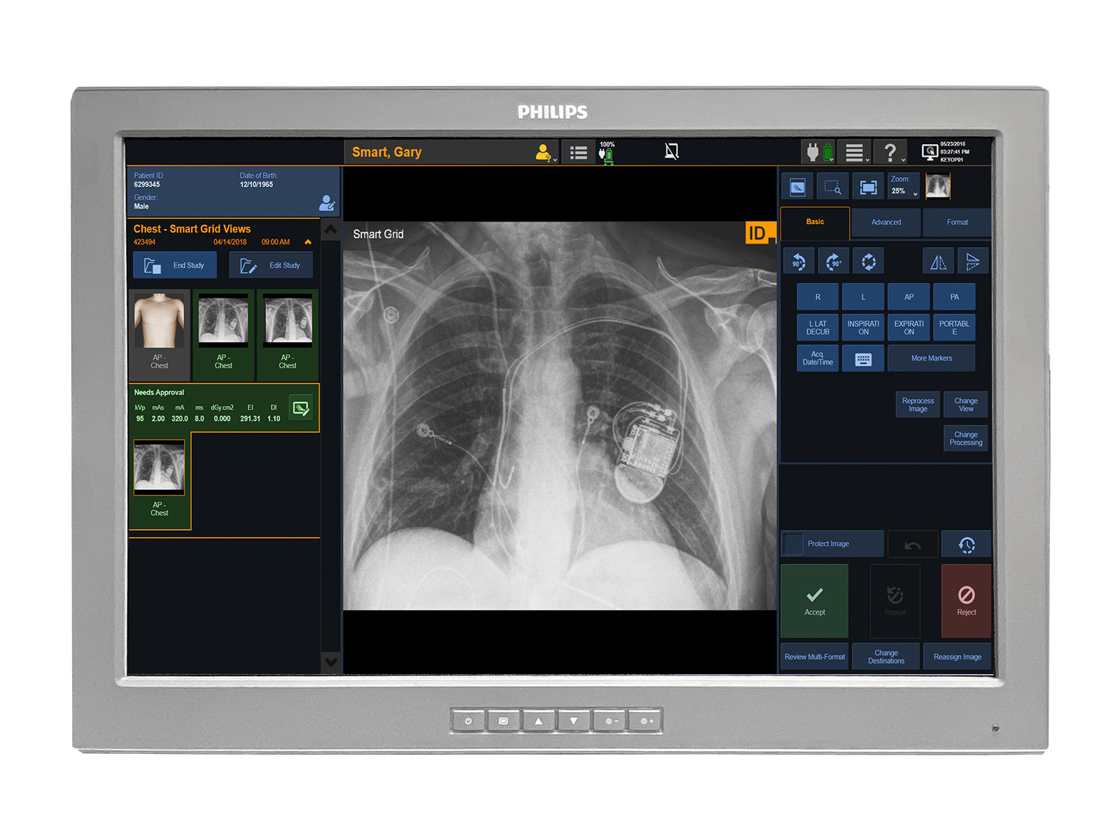 Barco P240-LAv MED24ESB 24" 2MP Philips DICOM (P240-LAv)