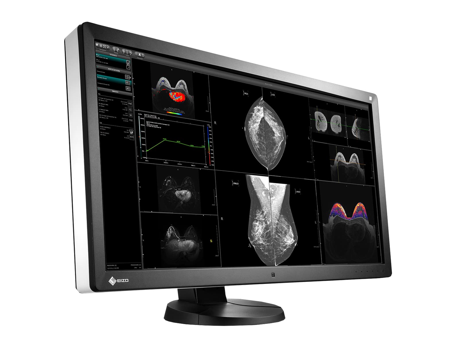 Eizo RadiForce RX850 8MP 31" Fusion Color LED Mammo 3D-DBT Breast Imaging Display (RX850-BK) Monitors.com 