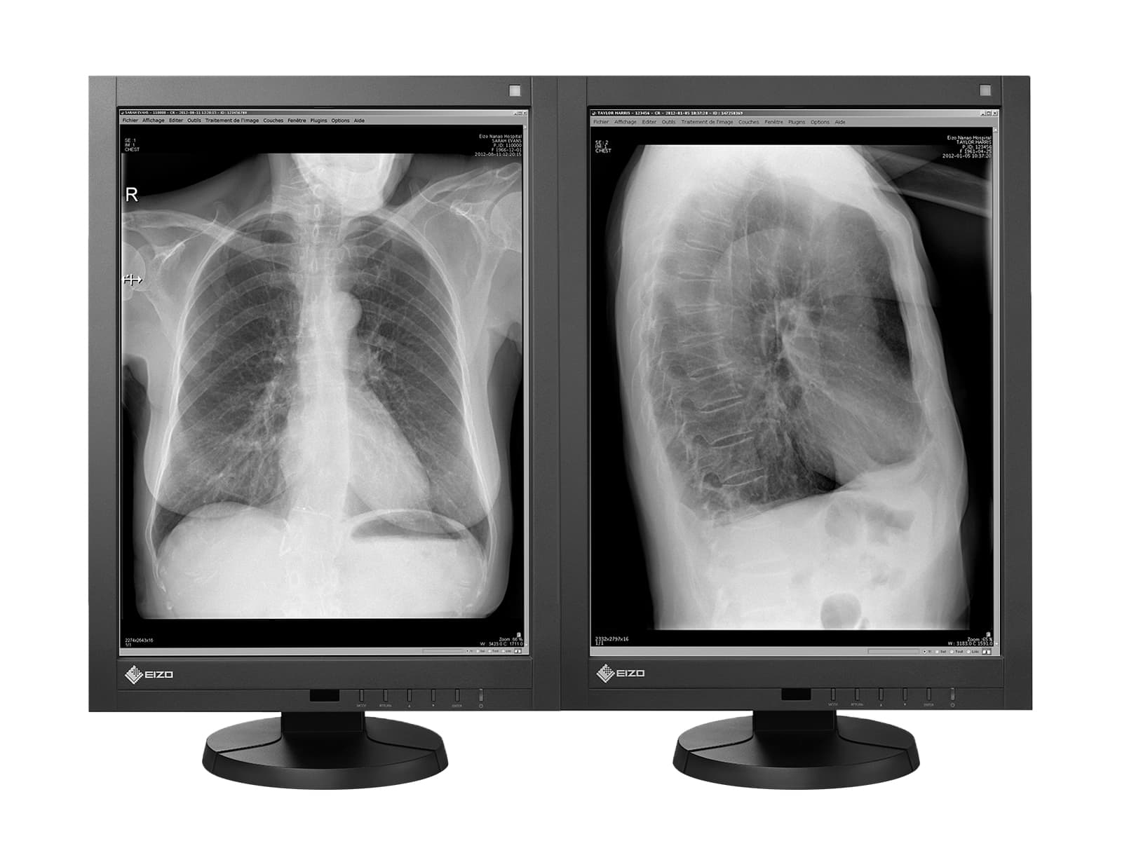 Eizo Radiforce GX240 21" 2MP Grayscale LED PACS Display Monitor (GX240) Monitors.com 