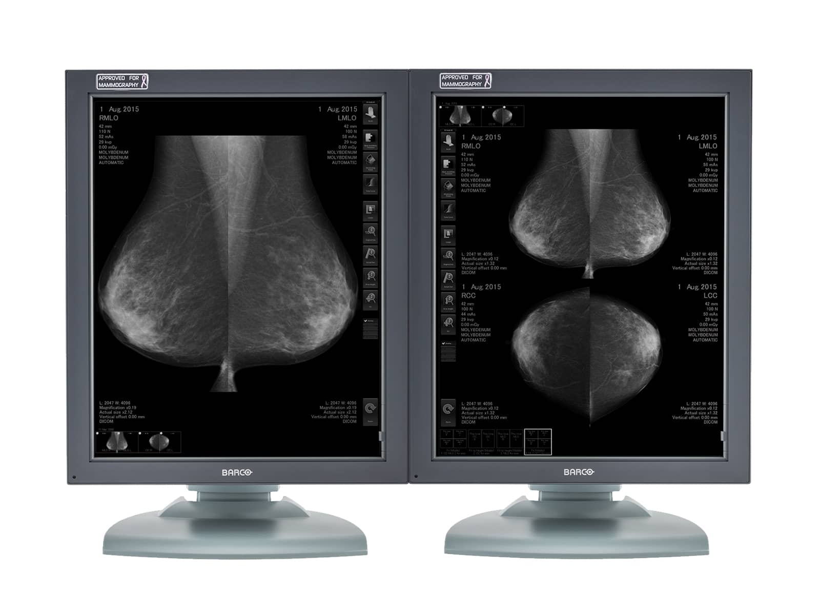 Barco Coronis MDMG-5121 5MP 21" Grayscale Breast Imaging PACS Mammography Display Monitors.com 