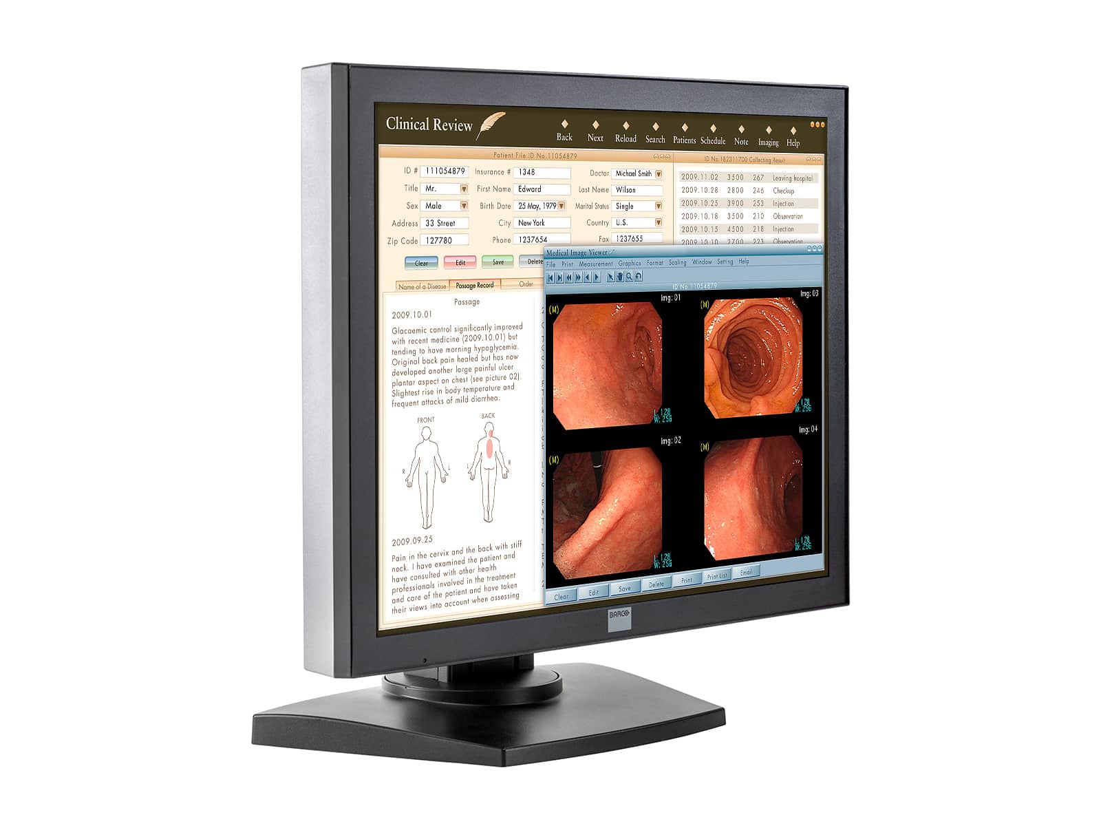 Barco MDRC-1119-TS 1MP 19" Touchscreen Color Clinical Review Display Monitors.com 