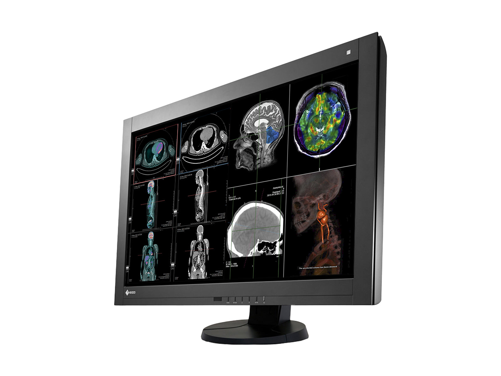 Eizo RadiForce RX440 4MP 30" Color LED General Radiology PACS Display (RX440-BK) Monitors.com 