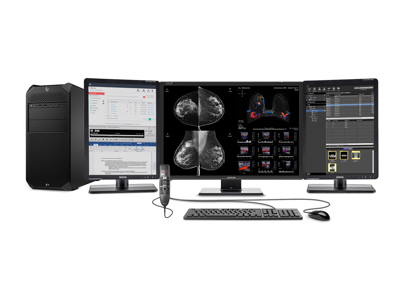 Complete Mammography Reading Station | Barco Nio Fusion 12MP Color | HP Z4 G5 Workstation | Dictation Mic | Worklist Monitors (12130Z4G5)