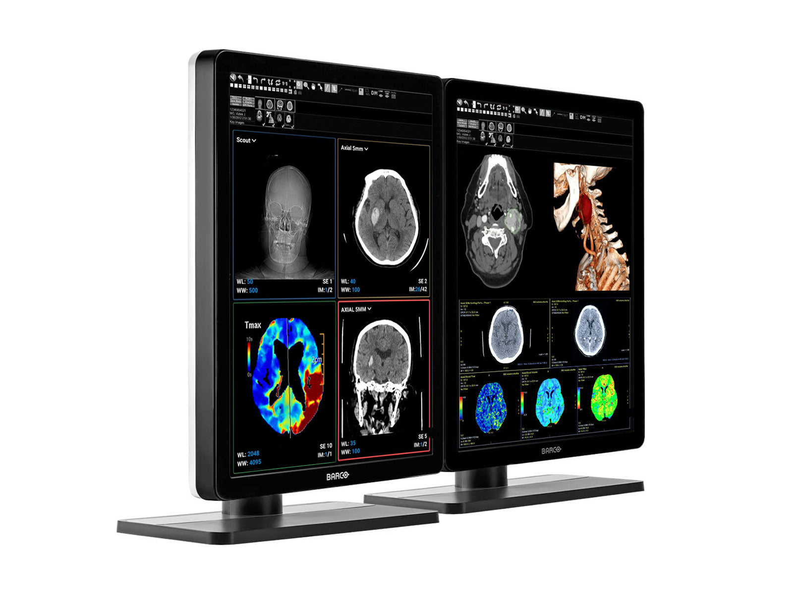 Barco Nio MDNC-3421 3MP 21" Color LED General Radiology PACS Display Monitors.com 