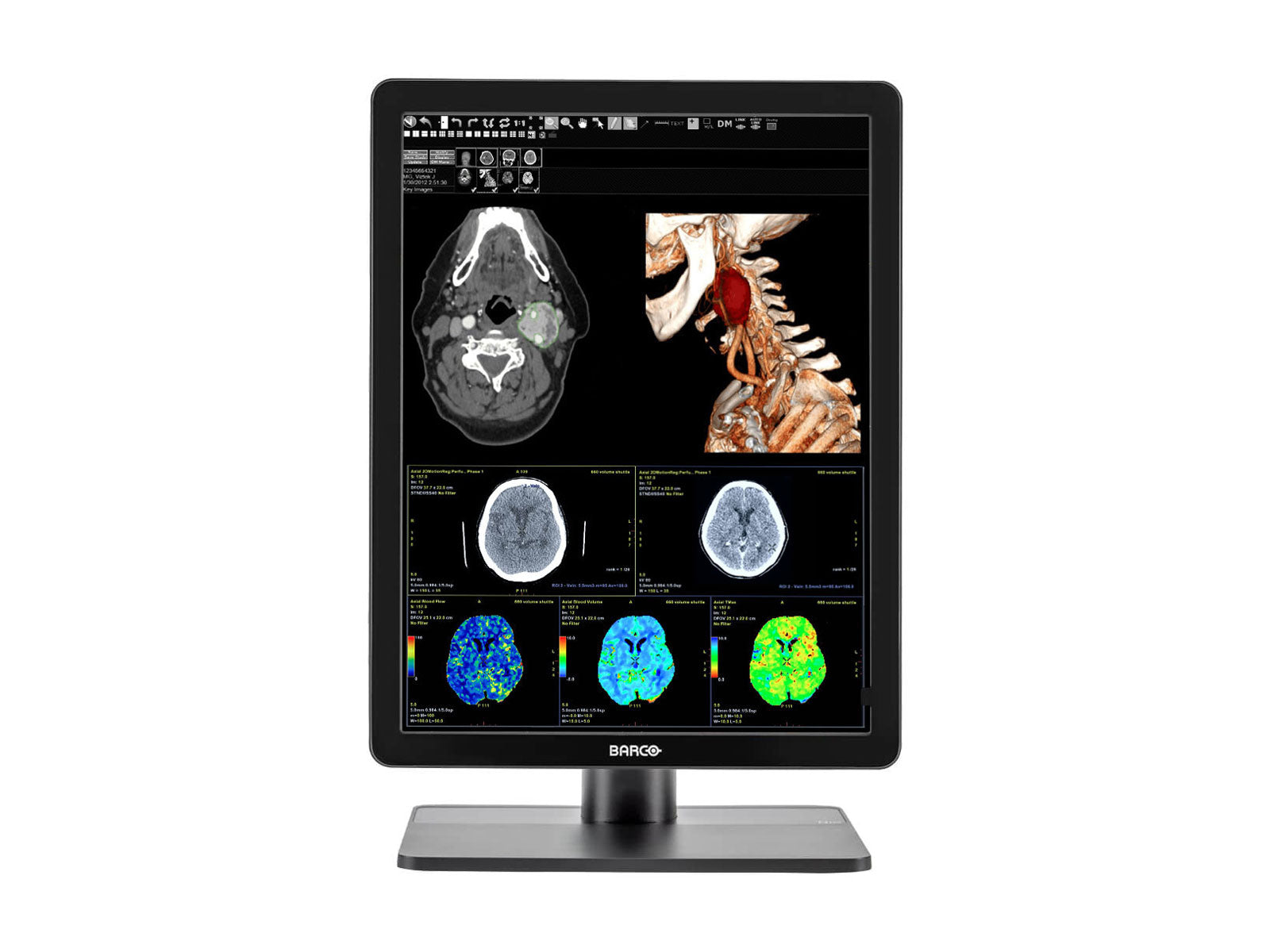 Barco Nio MDNC-3421 3MP 21" Color LED General Radiology PACS Display Monitors.com 