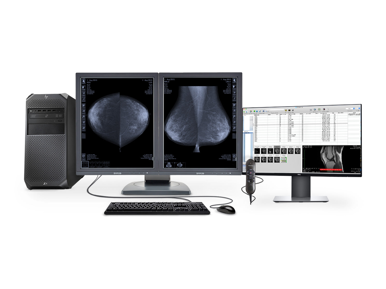 Complete Mammography Reading Station | Barco 5MP Grayscale 3D-DBT Displays | HP Workstation | Dictation Mic | Worklist Monitor (MD5121Z4R) Monitors.com 